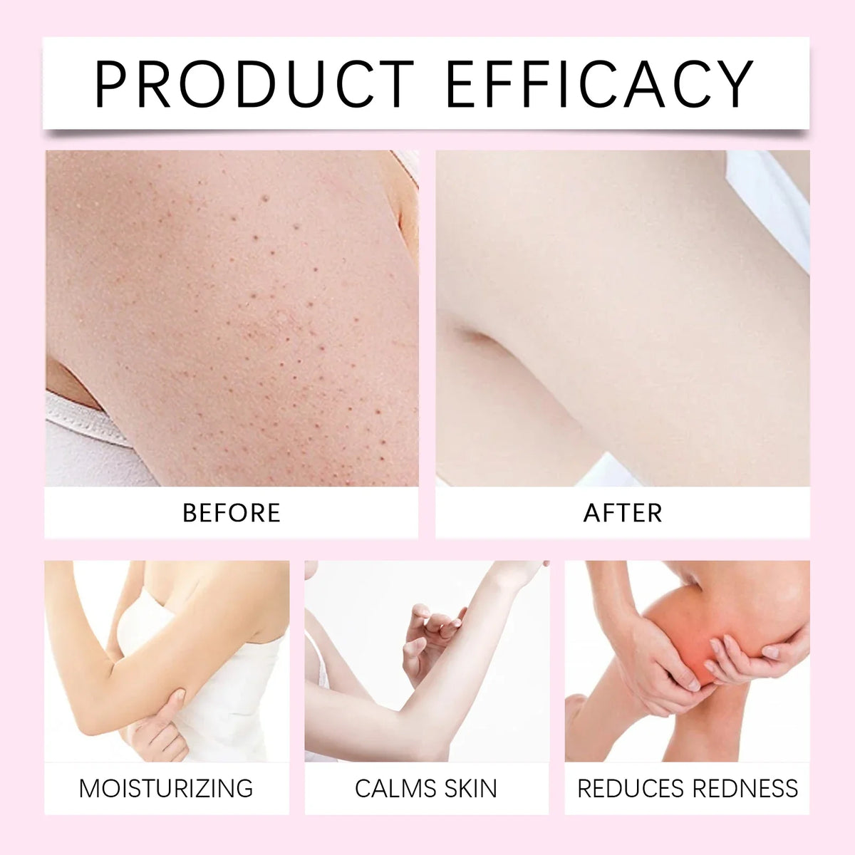Cyperus Rotundus Oil Natural Post Hair Removal Soothing Oil Hair Reduction Care Moisturizing Soothing Body Care for Smooth Skin