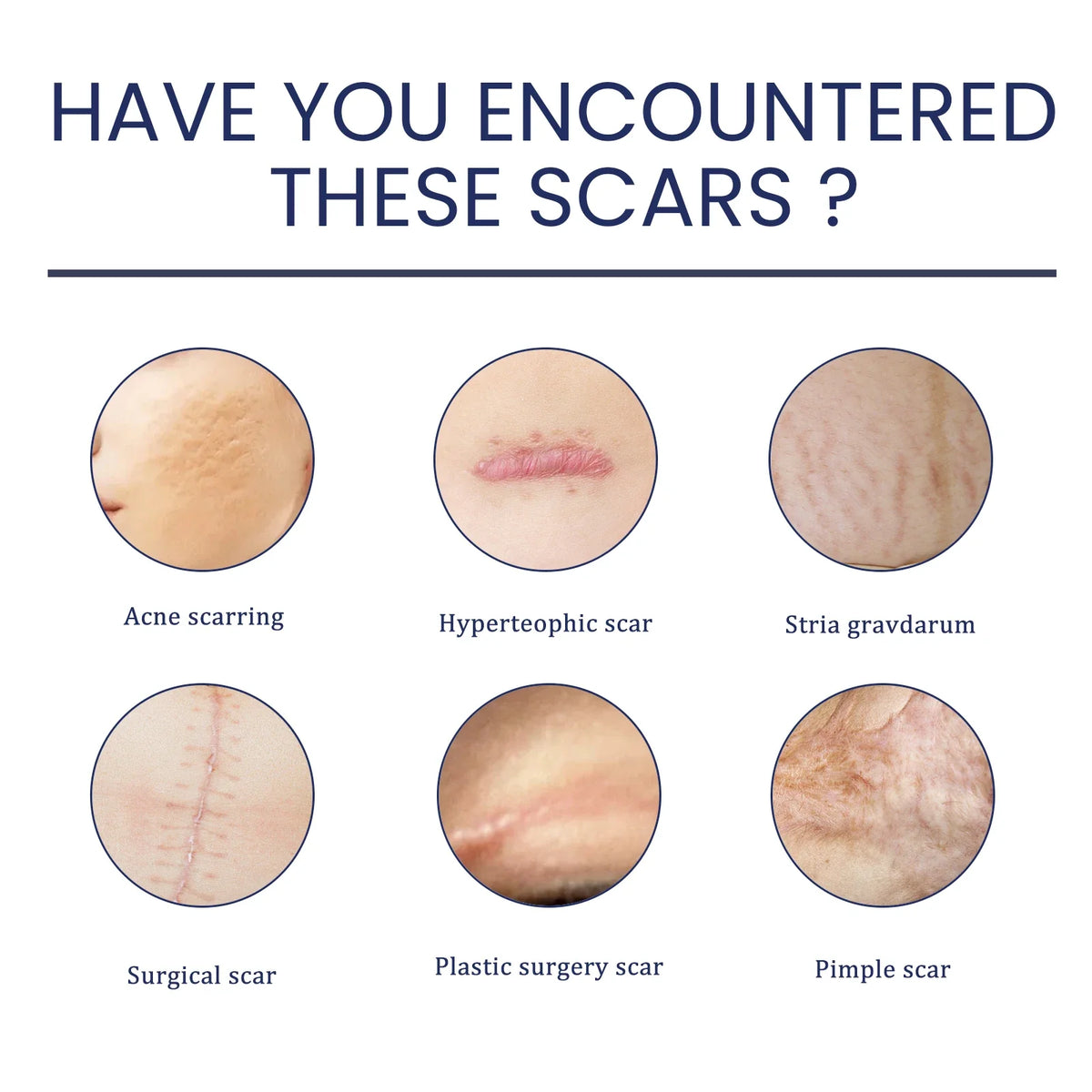 EELHOE Silicone Skin Scar Gel Retinol Niacinamide Scars Stretch Marks Burn Marks Deeply Nourish Skin Reduce Redness Swelling 30g