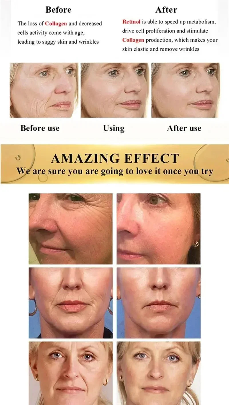 Bee Venom Anti-Aging Cream Rejuvenate face Skin Deep Moisturizing Fade Lines Fast Absorption Repair Instant Wrinkle Skincare