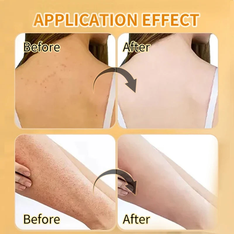Amococo 2Pcs Turmeric Body Scrub Exfoliating Dead Skin Remover 280g Deep Cleansing Nourishing Smooth Skin