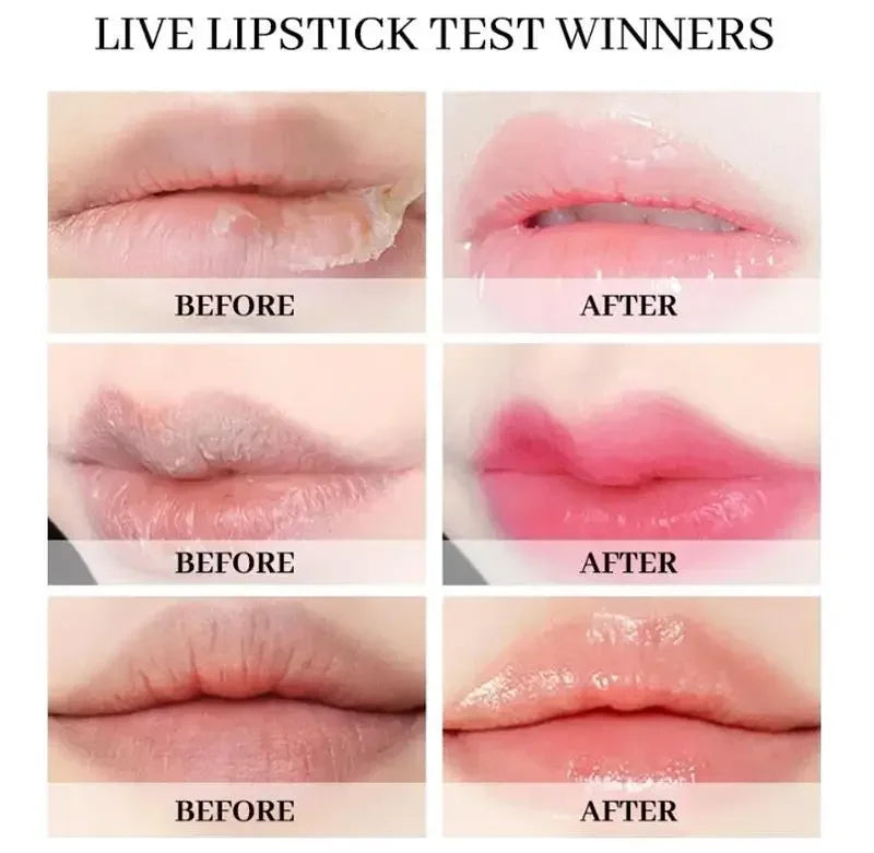 Fast Lightening Pink Mouth Lips Serum Bleaching Permanent Remove Dark Smoke Lips Lip Balm Moisturize Gloss Lipstick Lip Oil
