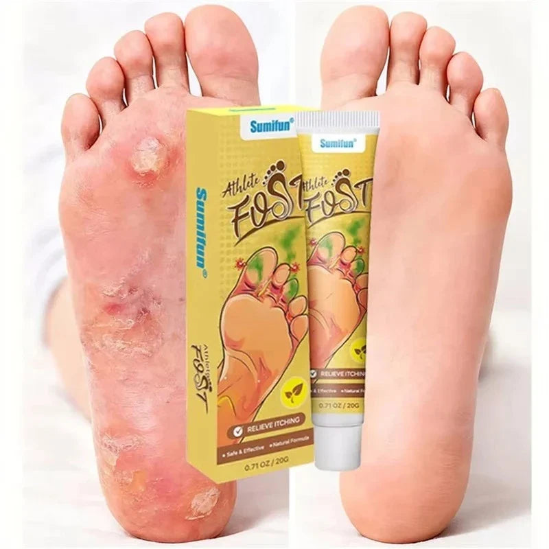 Anti-Foot Fungus Ointment Deodorant Care Products Foot Deodorant Creams Antiseptic and Antiperspirant Foot Skin Topical Cream